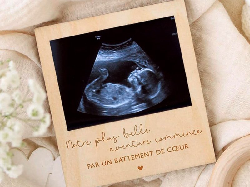 Cadre photo en bois avec une échographie de bébé, dos aimanté